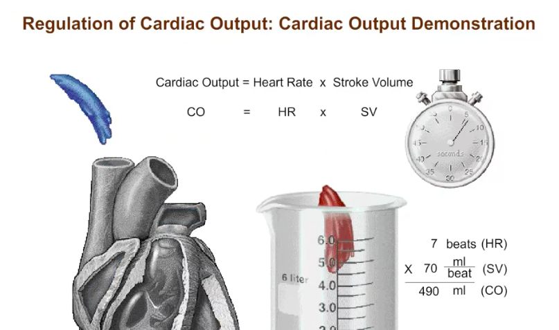Cardiac Preload And Afterload For Dummies – SVWWW